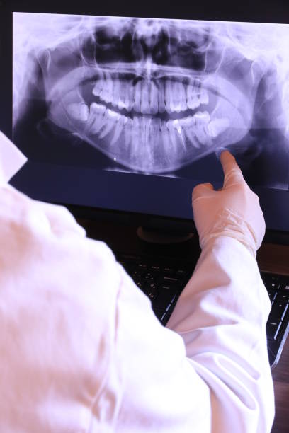 Best Knocked-Out Tooth Emergency  in Graton, CA
